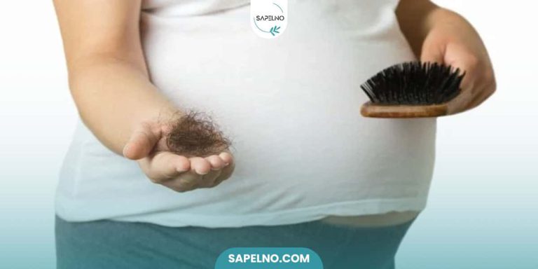 درمان ریزش مو در بارداری